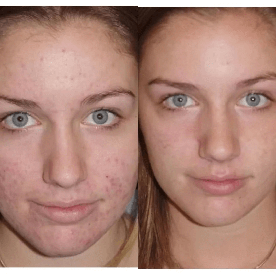 Evil Goods- Crema Facial  Balsamo de sebo de res y miel