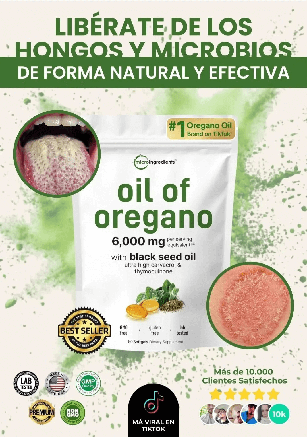 Aceite De Orégano -80 capsulas - Detox Natural Antifungico