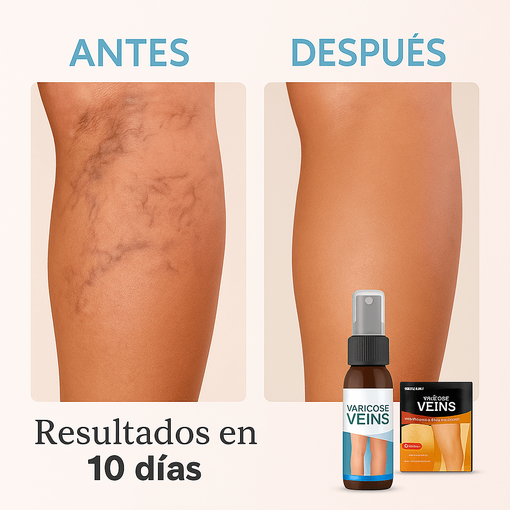 KIT VARICES SPRAY + 12 PARCH