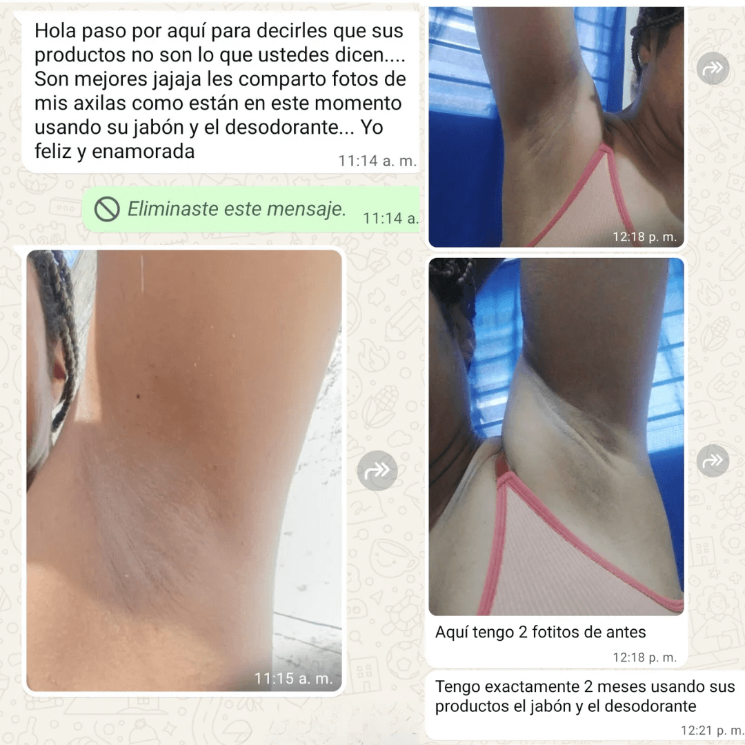 Jabón de cúrcuma anti acne-anti manchas oferta  2x1